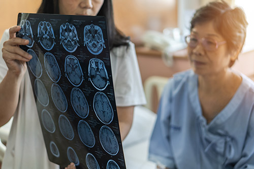 Diagnosing Alzheimer’s Disease - Canton, GA