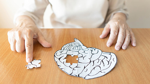 The Three Major Alzheimer’s Disease Stages with Brief Description - Canton, GA